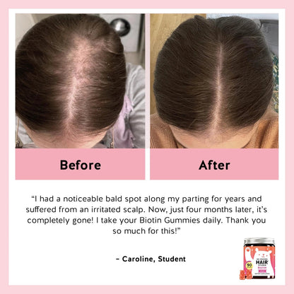 Biotin Gummies for Hair Skin & Nails. 5000 mcg High Potency Vegan Vitamins fo...